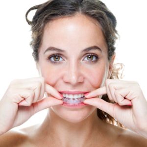 woman putting in clear aligner